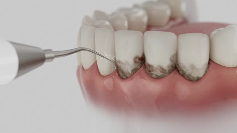 Trusted Teeth Cleaning And Checkup service in Cookson, OK - Dentist Open Now